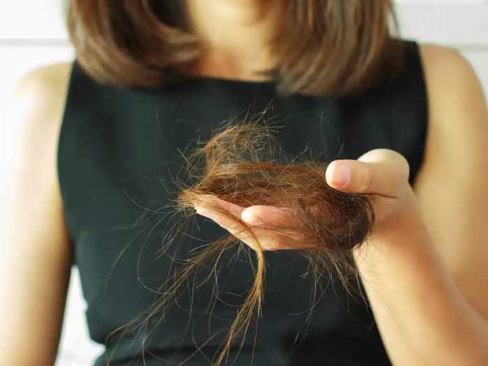 Hair lose